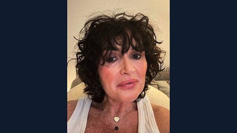 Cancer patient's 'scanxiety' with delay in scan results as HSE admit to needing more radiologists