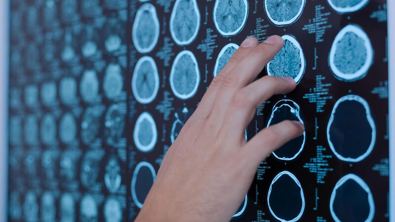 Just 13% of Cork patients on neurosurgery wait-list will be seen by end of year