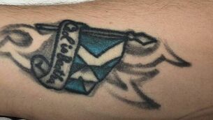 Gardaí release tattoo image to help identify Temple Bar attack victim as two men are arrested Gardaí release tattoo image to help identify Temple Bar attack victim as two men are arrested